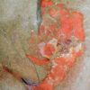 Strange flat-tailed carpoid - Plasiacystis - Image 5