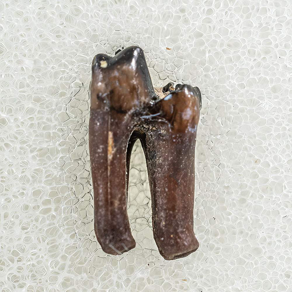 Metatherian Tooth